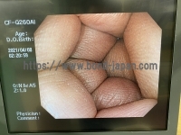 Video Colonoscope&nbsp;|&nbsp;OLYMPUS&nbsp;|&nbsp;PCF-Q260AZI