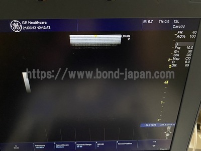超音波診断装置/カラードプラ&nbsp;|&nbsp;GEヘルスケア・ジャパン株式会社&nbsp;|&nbsp;LOGIQ e V2の写真