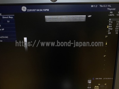 超音波診断装置/カラードプラ&nbsp;|&nbsp;GEヘルスケア・ジャパン株式会社&nbsp;|&nbsp;Logiq S7 Expertの写真