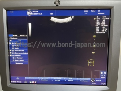 超音波診断装置/カラードプラ&nbsp;|&nbsp;GEヘルスケア・ジャパン株式会社&nbsp;|&nbsp;LOGIQ iMの写真