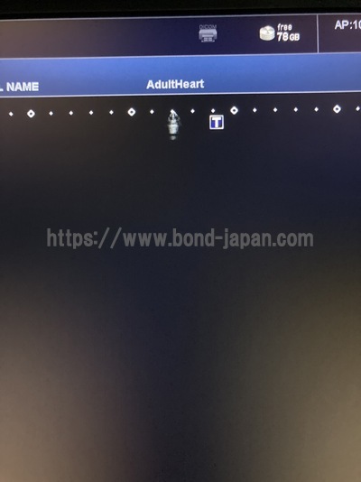 超音波診断装置/カラードプラ&nbsp;|&nbsp;キャノンメディカル株式会社&nbsp;|&nbsp;Xario 200の写真