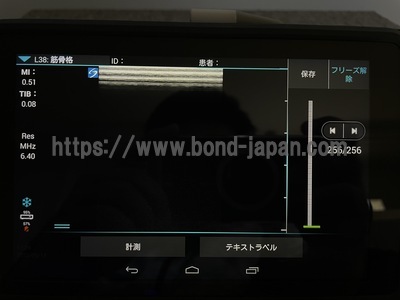 汎用超音波画像診断装置SonoSite iViz&nbsp;|&nbsp;富士フイルムヘルスケア&nbsp;|&nbsp;P21292-07の写真