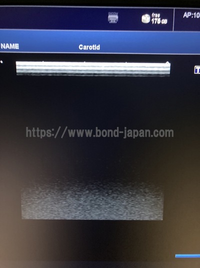 超音波診断装置/カラードプラ&nbsp;|&nbsp;キャノンメディカル株式会社&nbsp;|&nbsp;TUS-X100 Xario 100の写真
