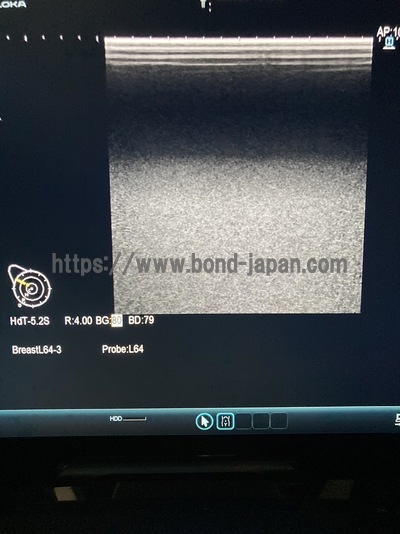 超音波診断装置&nbsp;|&nbsp;日立アロカメディカル株式会社&nbsp;|&nbsp;ARIETTA E70の写真