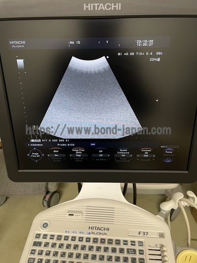 Color Doppler&nbsp;|&nbsp;HITACHI&nbsp;|&nbsp;F37
