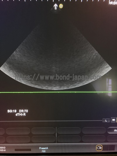 Color Doppler&nbsp;|&nbsp;HITACHI&nbsp;|&nbsp;Hi Vision Preirus