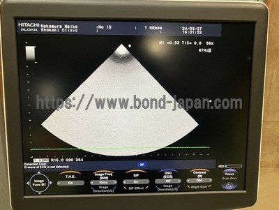 Color Doppler&nbsp;|&nbsp;HITACHI&nbsp;|&nbsp;F37