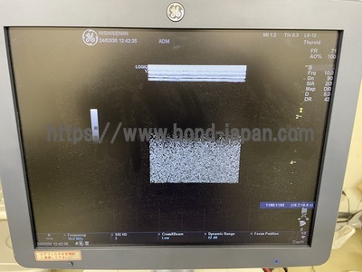 超音波診断装置/カラードプラ&nbsp;|&nbsp;GEヘルスケア・ジャパン株式会社&nbsp;|&nbsp;LOGIQ V5の写真