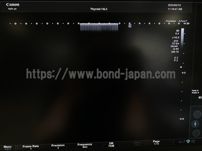 Ultrasound System&nbsp;|&nbsp;CANON&nbsp;|&nbsp;Aplio Go