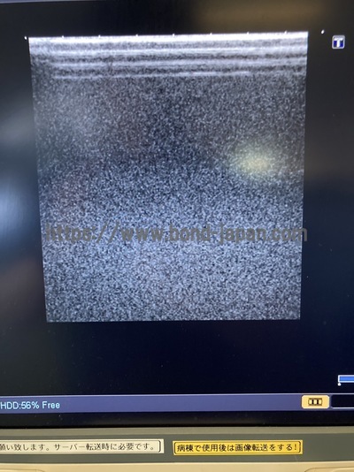 Color Doppler&nbsp;|&nbsp;CANON&nbsp;|&nbsp;SSA-660A Xario