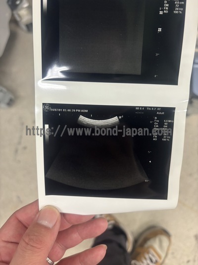 Color Doppler&nbsp;|&nbsp;GE&nbsp;|&nbsp;LOGIQ P5