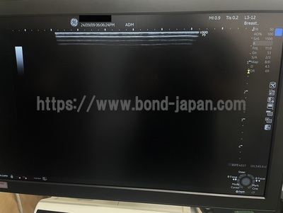 Ultrasound&nbsp;|&nbsp;GE&nbsp;|&nbsp;LOGIQ P9