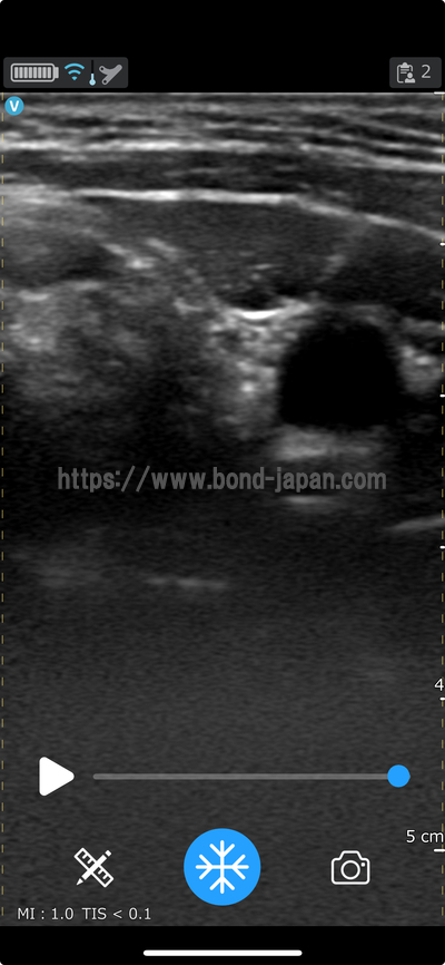 汎用超音波画像診断装置&nbsp;|&nbsp;GEヘルスケア・ジャパン株式会社&nbsp;|&nbsp;Vscan Air CLの写真