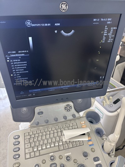 Color Doppler&nbsp;|&nbsp;GE&nbsp;|&nbsp;LOGIQ P6