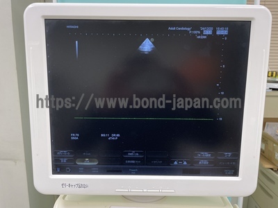 Color Doppler&nbsp;|&nbsp;HITACHI&nbsp;|&nbsp;Hi Vision Avius