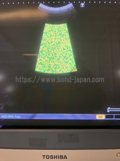 Color Doppler&nbsp;|&nbsp;CANON&nbsp;|&nbsp;SSA-660A Xario