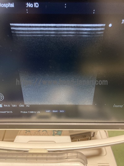 Color Doppler&nbsp;|&nbsp;HITACHI&nbsp;|&nbsp;F75