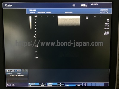 &nbsp;|&nbsp;CANON&nbsp;|&nbsp;TUS-X100S  Xario 100S