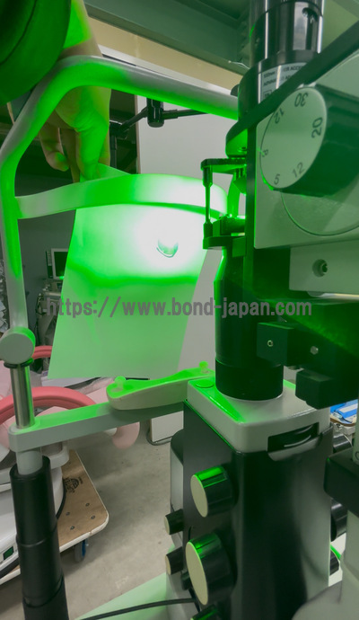 Retinal Laser System&nbsp;|&nbsp;Alcon&nbsp;|&nbsp;PUREPOINT