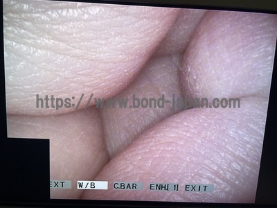 Video Rhinolaryngoscope&nbsp;|&nbsp;OLYMPUS&nbsp;|&nbsp;ENF-VQ