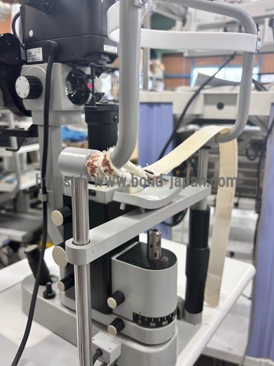 532 Green Laser with a slit lamp&nbsp;|&nbsp;NIDEK&nbsp;|&nbsp;GYC1000