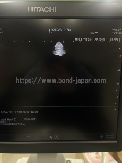 Ultrasound System&nbsp;|&nbsp;HITACHI&nbsp;|&nbsp;ARIETTA 60