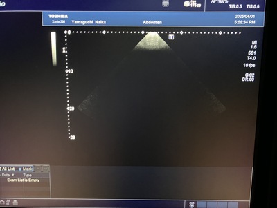 Color Doppler&nbsp;|&nbsp;CANON&nbsp;|&nbsp;Xario 200