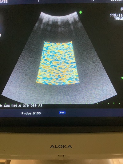 &nbsp;|&nbsp;HITACHI&nbsp;|&nbsp;Prosound Alpha 10