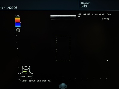 Ultrasound System&nbsp;|&nbsp;FUJIFILM&nbsp;|&nbsp;ARIETTA 50