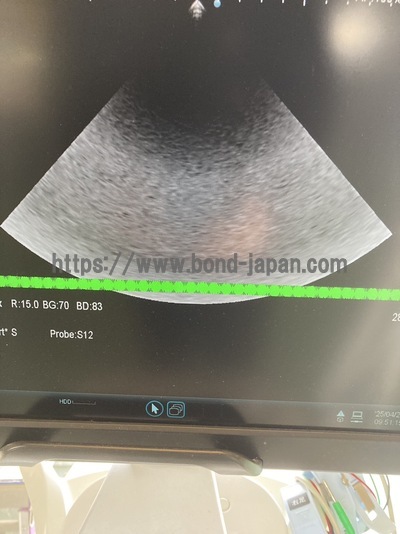 &nbsp;|&nbsp;Fujifilm&nbsp;|&nbsp;ARIETTA 70