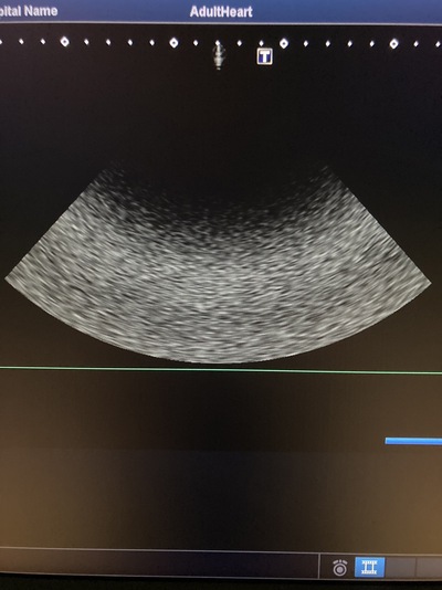 Color Doppler&nbsp;|&nbsp;CANON&nbsp;|&nbsp;Xario 200