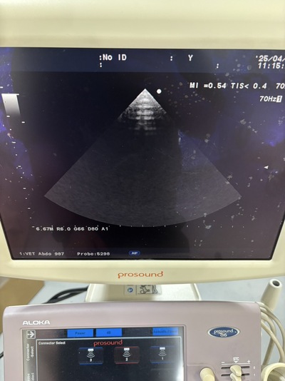 Color Doppler&nbsp;|&nbsp;HITACHI&nbsp;|&nbsp;Prosound α6