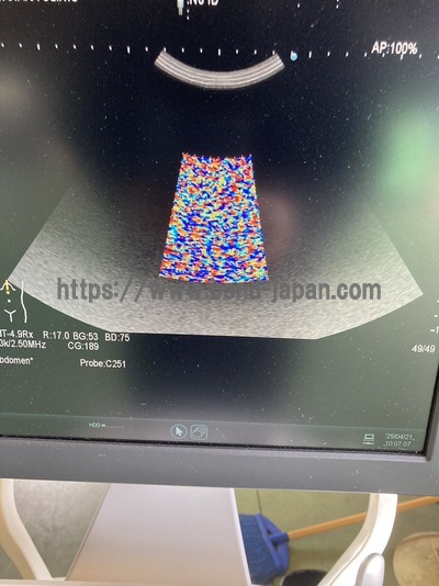 Ultrasound System&nbsp;|&nbsp;HITACHI&nbsp;|&nbsp;ARIETTA 60