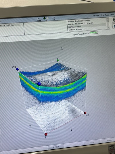 OCT&nbsp;|&nbsp;Carl Zeiss&nbsp;|&nbsp;Cirrus 500 HD-OCT Plus