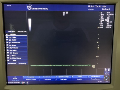 Color Doppler&nbsp;|&nbsp;GE&nbsp;|&nbsp;LOGIQ P5