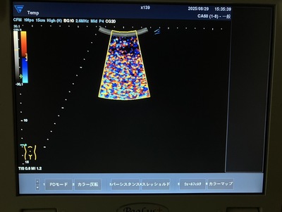 &nbsp;|&nbsp;FUKUDA DENSHI&nbsp;|&nbsp;UF-760AG+