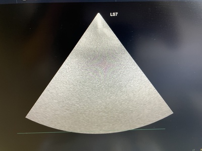 Color Doppler&nbsp;|&nbsp;GE&nbsp;|&nbsp;Logiq S7 Expert