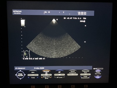 Color Doppler&nbsp;|&nbsp;HITACHI&nbsp;|&nbsp;F37