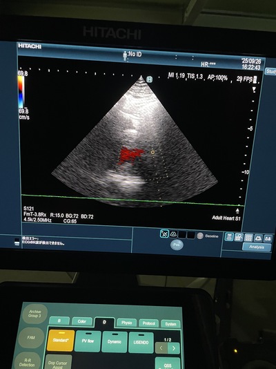 Ultrasound System&nbsp;|&nbsp;FUJIFILM&nbsp;|&nbsp;ARIETTA 850
