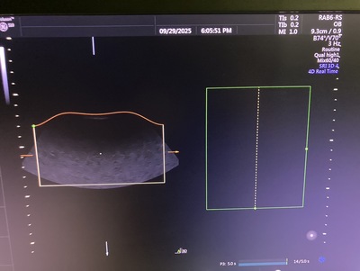 4D Ultrasound&nbsp;|&nbsp;GE&nbsp;|&nbsp;Voluson S10 BT16