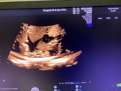 4D Ultrasound&nbsp;|&nbsp;GE&nbsp;|&nbsp;Voluson E10 BT17