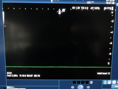Ultrasound System&nbsp;|&nbsp;FUJIFILM&nbsp;|&nbsp;ARIETTA 850