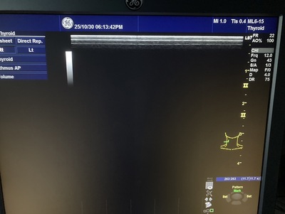 Color Doppler&nbsp;|&nbsp;GE&nbsp;|&nbsp;Logiq S7 Expert