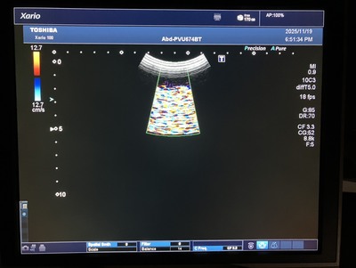 &nbsp;|&nbsp;CANON&nbsp;|&nbsp;TUS-X100S  Xario 100S