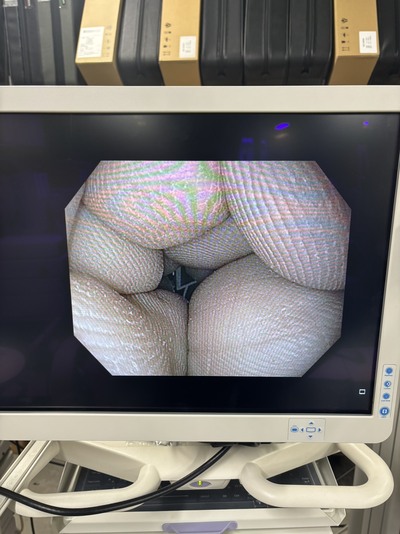 Video Gastroscope&nbsp;|&nbsp;OLYMPUS&nbsp;|&nbsp;GIF-H190N