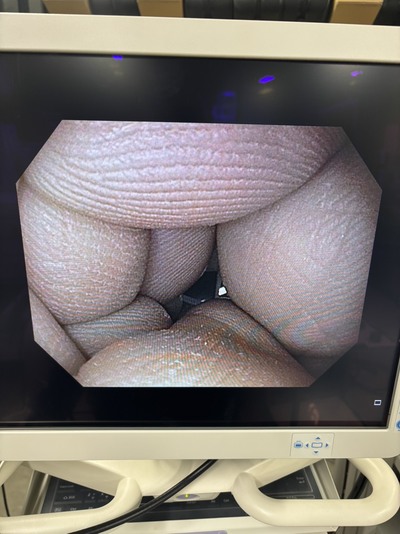 Video Gastroscope&nbsp;|&nbsp;OLYMPUS&nbsp;|&nbsp;GIF-H190N