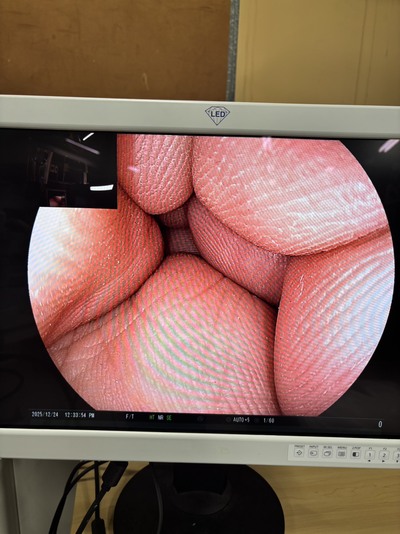 Video Gastroscope&nbsp;|&nbsp;FUJIFILM&nbsp;|&nbsp;EG-590WR2