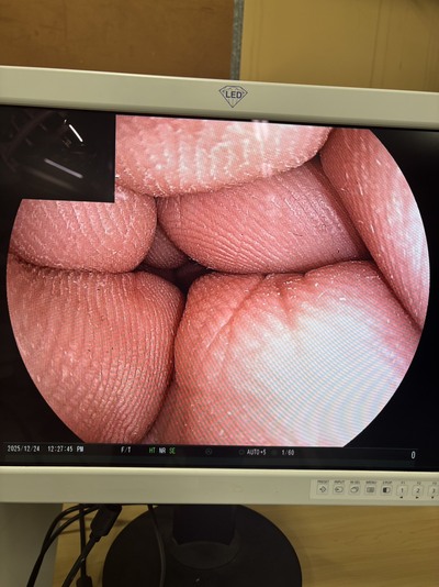 Video Gastroscope&nbsp;|&nbsp;FUJIFILM&nbsp;|&nbsp;EG-590WR2