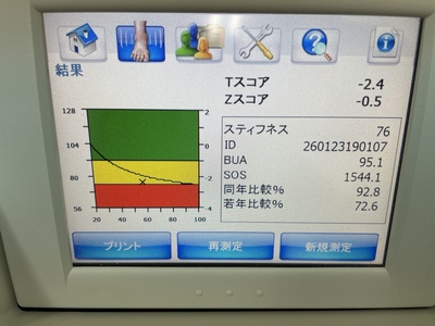 Bone Densitometry&nbsp;|&nbsp;GE&nbsp;|&nbsp;A-1000 EXP II