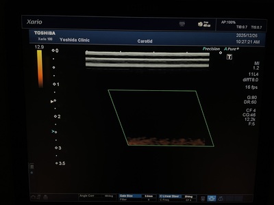 Color Doppler&nbsp;|&nbsp;CANON&nbsp;|&nbsp;TUS-X100 Xario 100